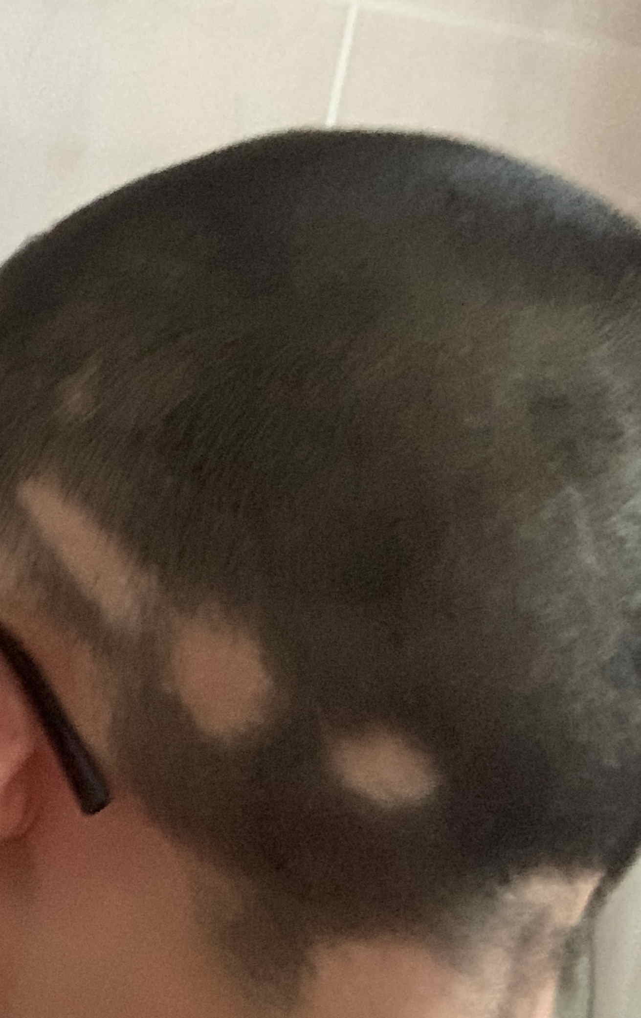 image of bald spots